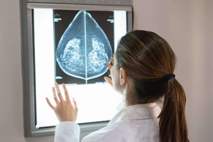 Informe advierte de las desigualdades que dejan atrás a muchas pacientes con cáncer mamario