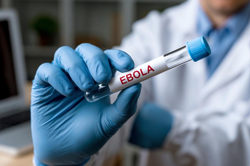 ebola