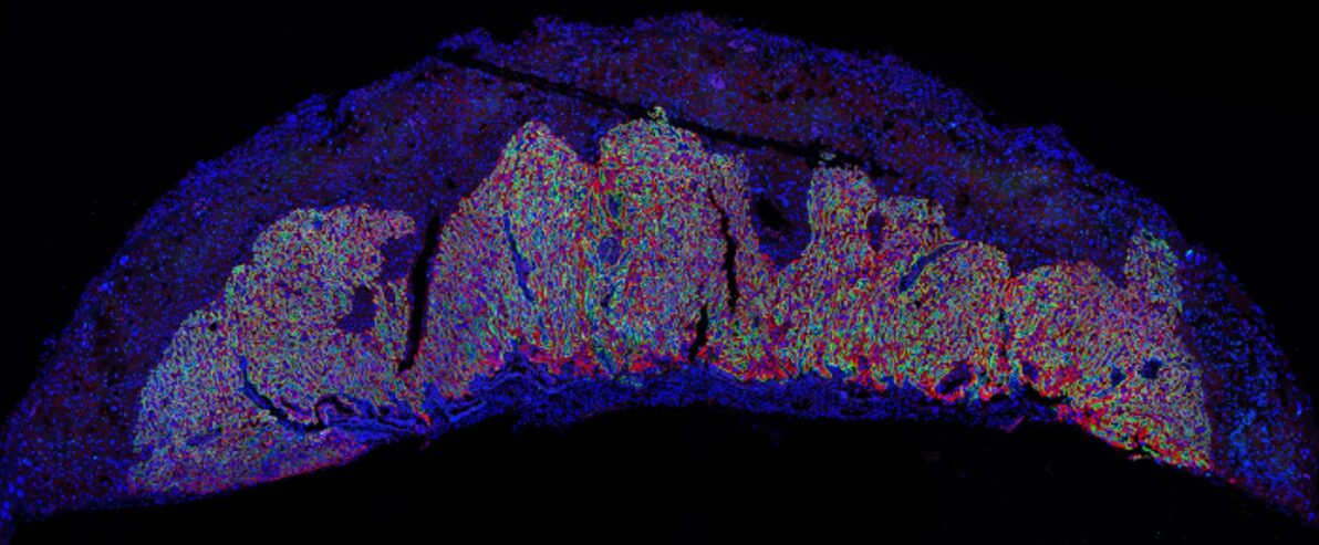 Placenta